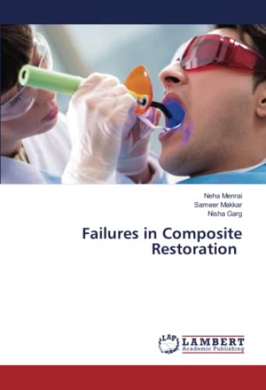 Failures in Composite Restoration