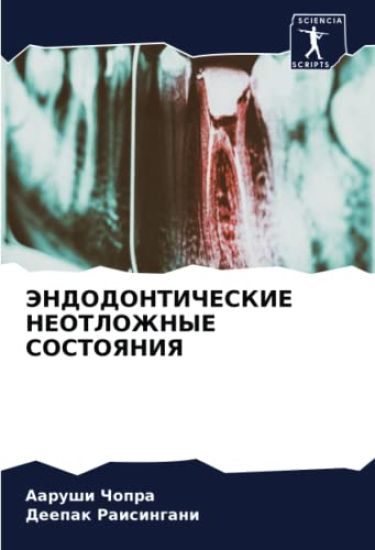 JeNDODONTIChESKIE NEOTLOZhNYE SOSTOYaNIYa