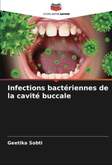 Infections bactériennes de la cavité buccale