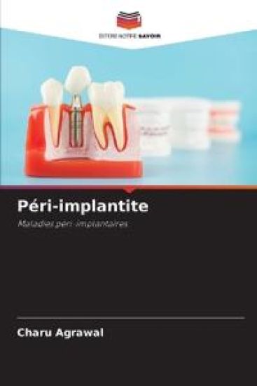 Péri-implantite