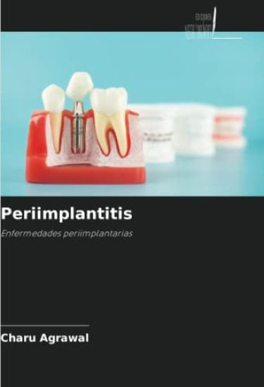 Periimplantitis