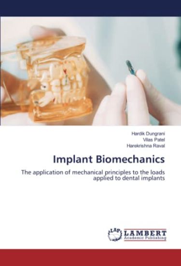 Implant Biomechanics