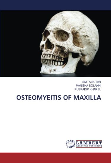 Osteomyeitis of Maxilla