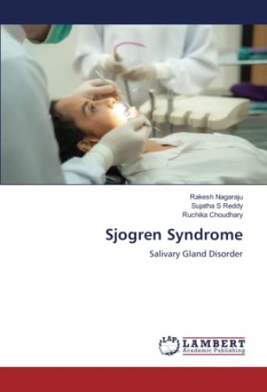 Sjogren Syndrome