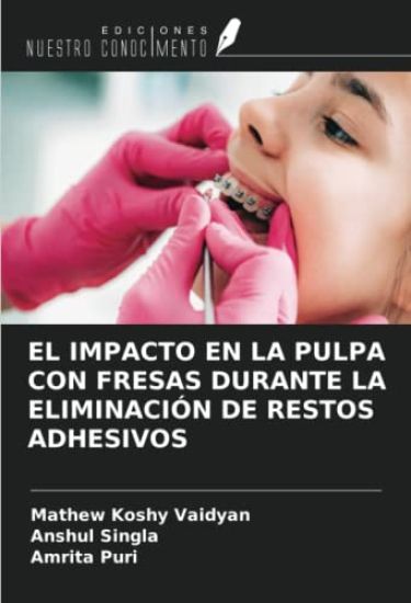 EL IMPACTO EN LA PULPA CON FRESAS DURANTE LA ELIMINACIÓN DE RESTOS ADHESIVOS
