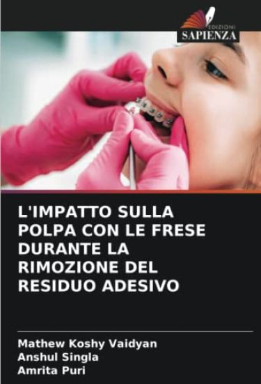 L'Impatto Sulla Polpa Con Le Frese Durante La Rimozione del Residuo Adesivo