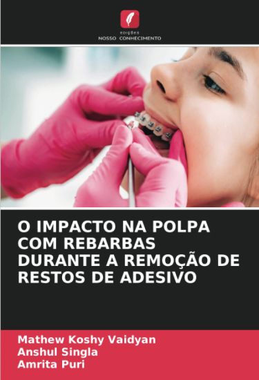 O Impacto Na Polpa Com Rebarbas Durante a Remoção de Restos de Adesivo