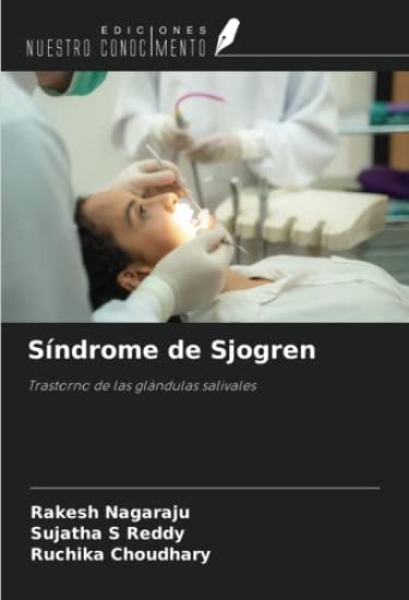 Síndrome de Sjogren