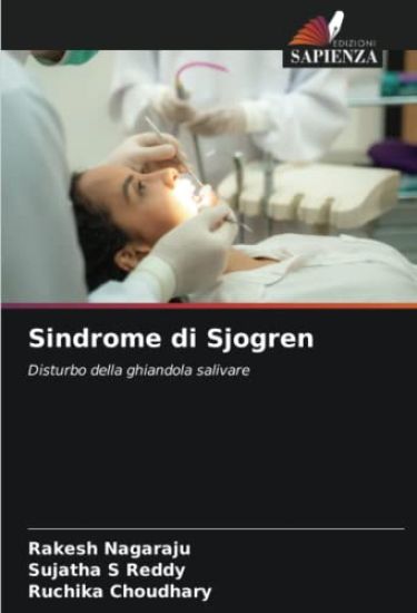 Sindrome di Sjogren