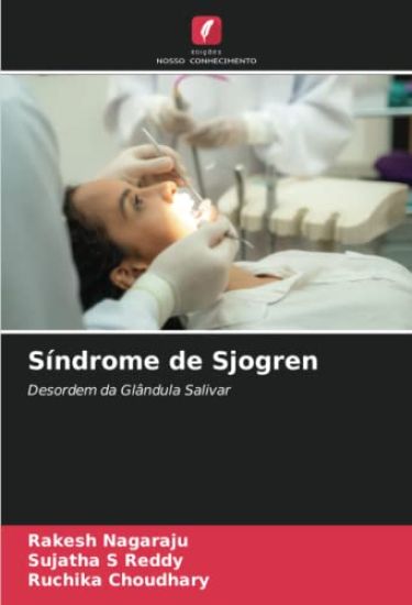 Síndrome de Sjogren