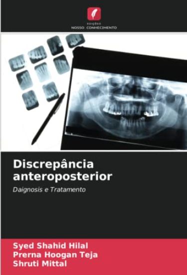 Discrepância anteroposterior