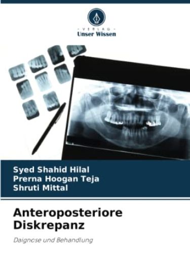 Anteroposteriore Diskrepanz