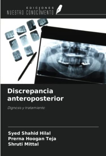 Discrepancia anteroposterior