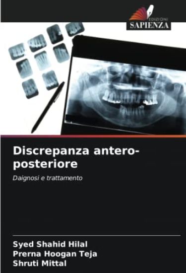 Discrepanza antero-posteriore