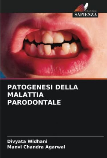 Patogenesi Della Malattia Parodontale