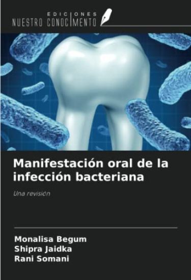 Manifestación oral de la infección bacteriana