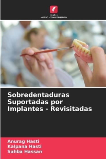 Sobredentaduras Suportadas por Implantes - Revisitadas