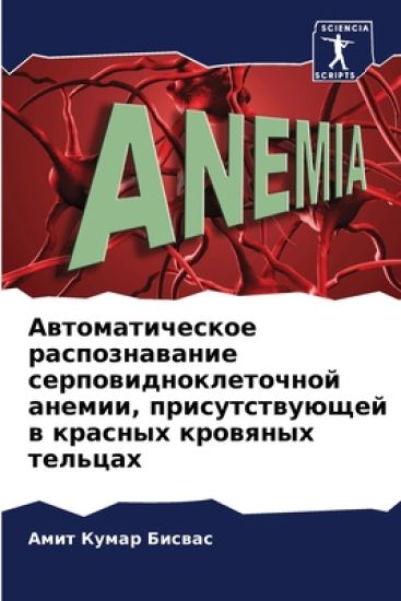 Автоматическое распозн&#