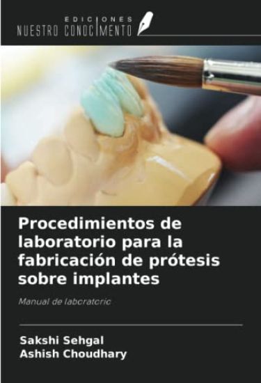 Procedimientos de laboratorio para la fabricación de prótesis sobre implantes