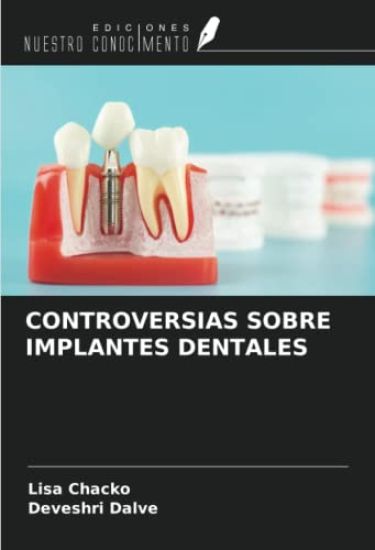 CONTROVERSIAS SOBRE IMPLANTES DENTALES