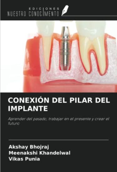 CONEXIÓN DEL PILAR DEL IMPLANTE