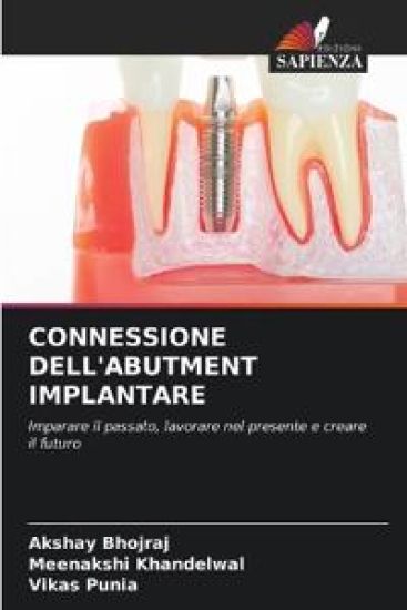 Connessione Dell'abutment Implantare
