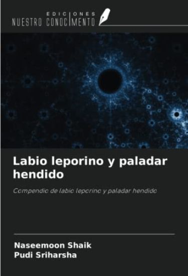 Labio leporino y paladar hendido