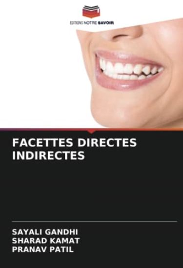 Facettes Directes Indirectes