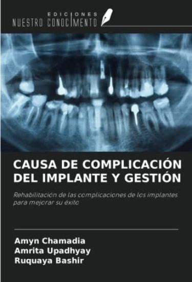 CAUSA DE COMPLICACIÓN DEL IMPLANTE Y GESTIÓN