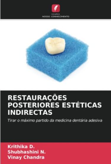 Restaurações Posteriores Estéticas Indirectas