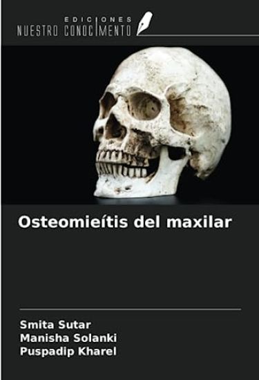 Osteomieítis del maxilar