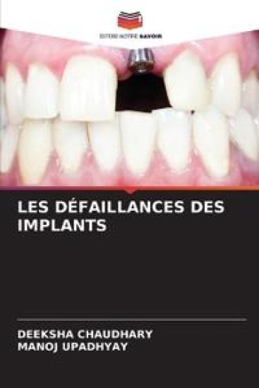 Les Défaillances Des Implants