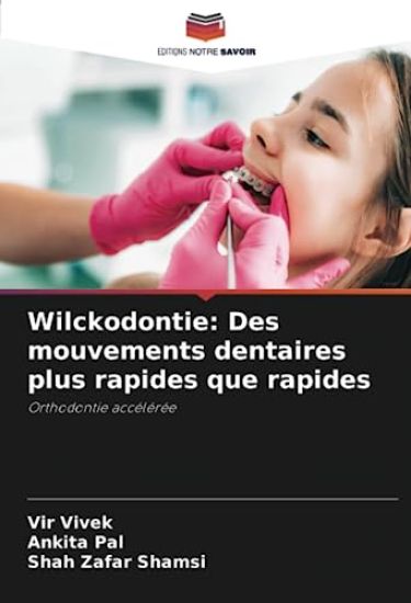Wilckodontie