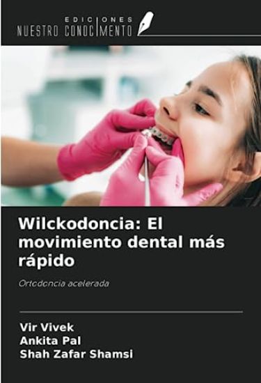 Wilckodoncia: El movimiento dental más rápido