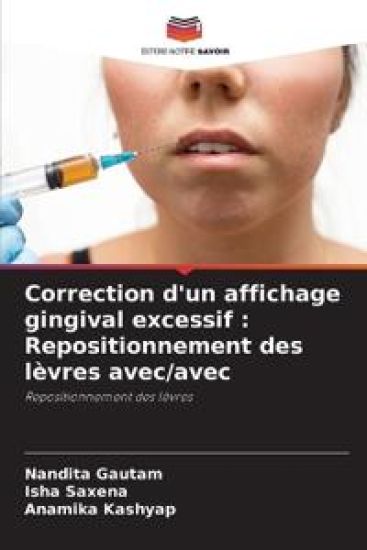 Correction d'un affichage gingival excessif