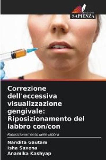 Correzione dell'eccessiva visualizzazione gengivale