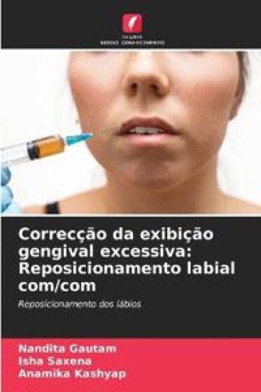 Correcção da exibição gengival excessiva