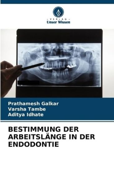 Bestimmung Der Arbeitslänge in Der Endodontie