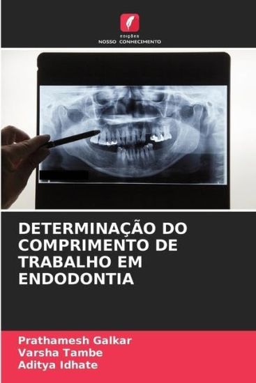 Determinação Do Comprimento de Trabalho Em Endodontia