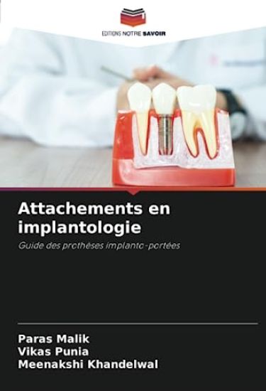 Attachements en implantologie