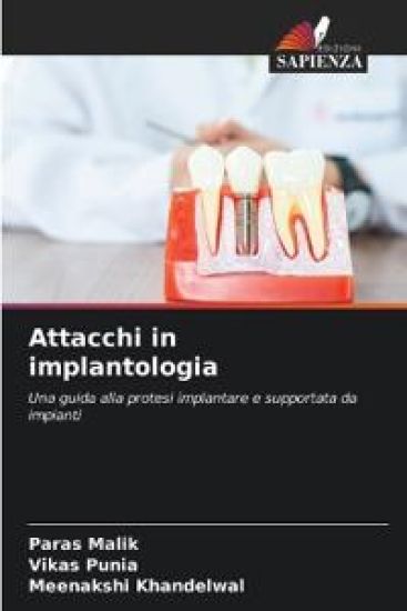 Attacchi in implantologia