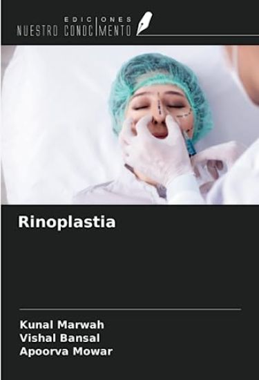 Rinoplastia