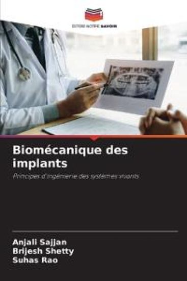 Biomécanique des implants