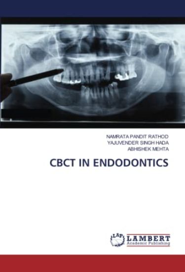 Cbct in Endodontics