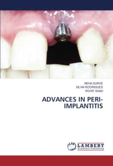 Advances in Peri-Implantitis