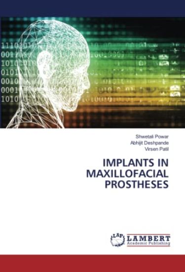 Implants in Maxillofacial Prostheses