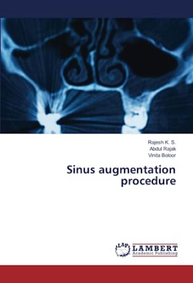 Sinus augmentation procedure