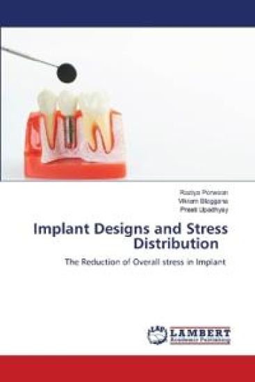 Implant Designs and Stress Distribution – Raziya Perween, kirjan kansikuva