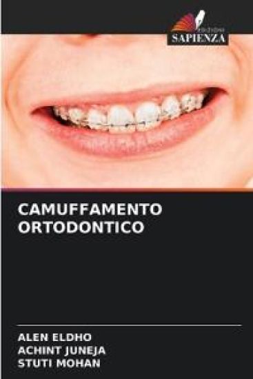 Camuffamento Ortodontico