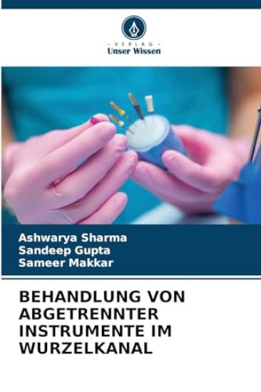 Behandlung Von Abgetrennter Instrumente Im Wurzelkanal